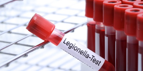 ¿Cómo eliminar la Legionella del agua?